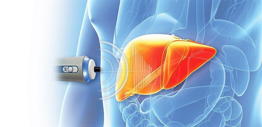 
Siêu âm có nhiều giá trị trong chẩn đoán viêm gan
