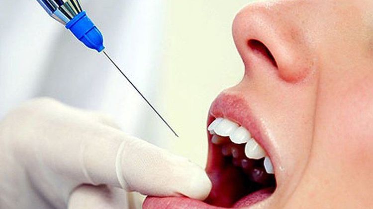 
Gây tê được dùng khi thực hiện những tiểu phẫu
