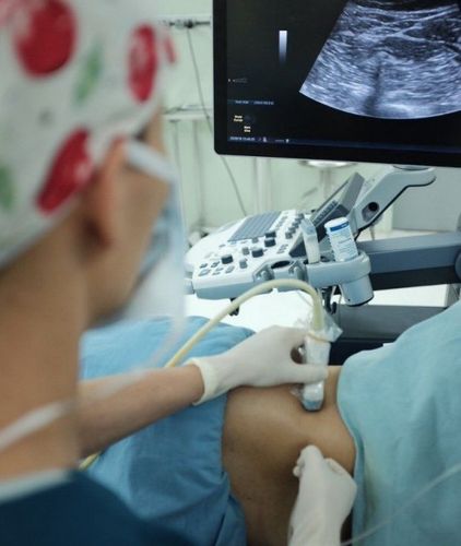 
Các bác sĩ Vinmec luôn siêu âm trước khi thực hiện bất kì một thủ thuật gây tê vùng để mũi kim tiêm đúng vị trí mong muốn, đảm bảo an toàn và hiệu quả.
