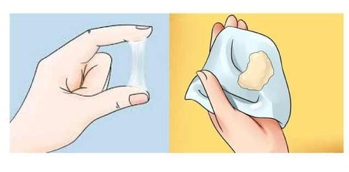 
Các loại dịch âm đạo được phân loại dựa trên màu sắc và tính nhất quán của chúng
