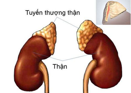 
Chỉ định chụp số hóa xóa nền và lấy máu tĩnh mạch thượng thận siêu chọn lọc với trường hợp tăng sản lượng thận
