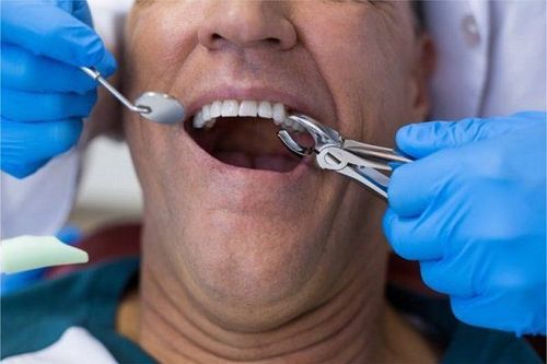 
Hút thuốc lá làm chậm lành vết thương sau khi điều trị nha khoa
