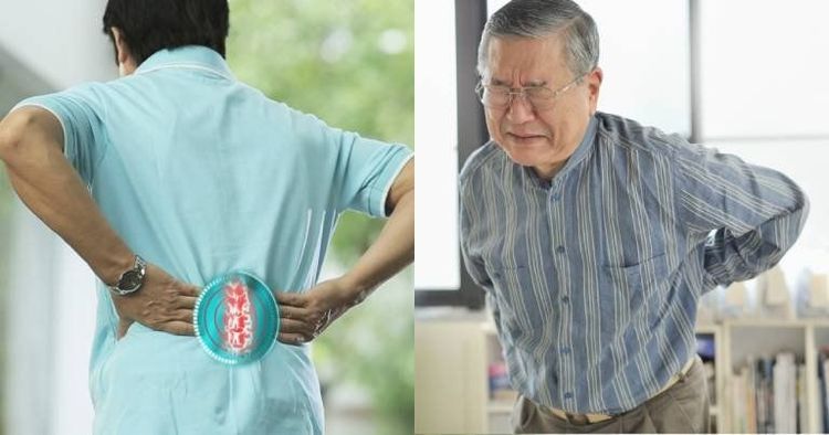
Bệnh rễ thần kinh tủy sống là biểu hiện rễ thần kinh tủy cổ bị tổn thương
