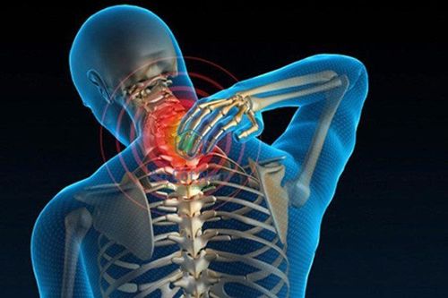 
Bệnh đau dây thần kinh ở cổ thường có các biểu hiện đa dạng
