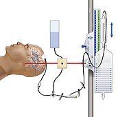 
Máy Catheter nhu mô não thất được sử dụng phổ biến để đo áp lực nội sọ
