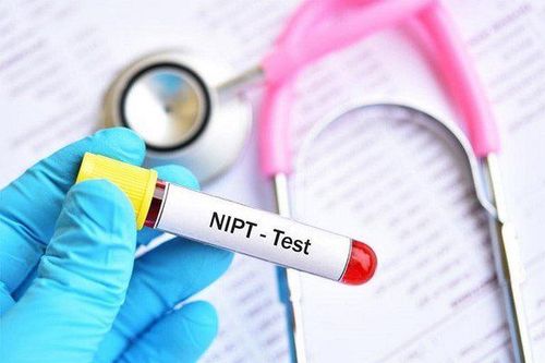 Làm xét nghiệm NIPT khi thai hơn 7 tuần có chính xác không?