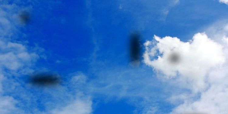 
Khi người bệnh xuất hiện đột ngột các đốm nhỏ trước mắt cần đi khám bác sĩ ngay
