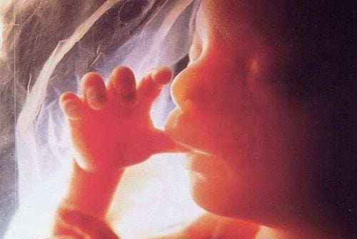 
Viêm nhiễm làm cho màng ối mỏng dễ dẫn đến hiện tượng rỉ ối.

