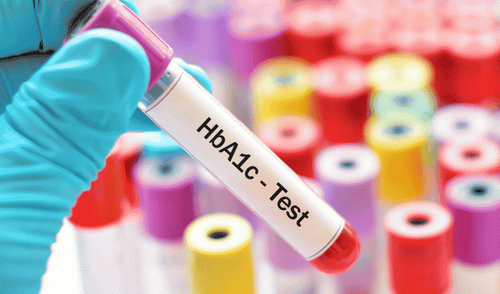 
Nồng độ HbA1c sẽ tương quan thuận với nồng độ glucose huyết tương
