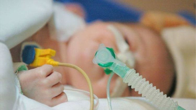 
Trẻ có thể gặp biến chứng suy hô hấp nếu quá trình thực hiện gây mê không an toàn

