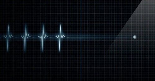 
Điện giật có thể khiến nạn nhân tử vong do tim ngừng thở
