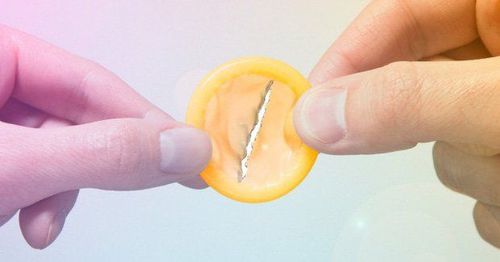 
Bao cao su bị rách do sai lệch kích thước khi sử dụng
