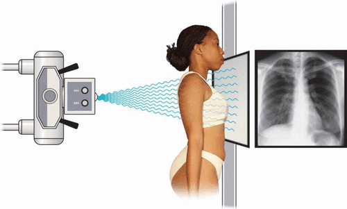 
Nguyên lý chụp phim X-quang tim phổi

