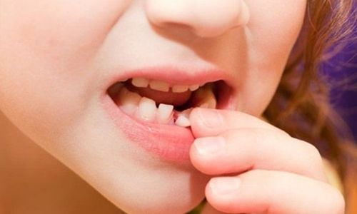 
Gây tê là kỹ thuật đơn giản bác sĩ chỉ cần bôi hoặc tiêm thuốc tê vào vị trí nhổ răng
