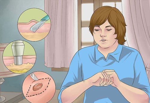 
Sinh thiết da giúp chẩn đoán bệnh da xuất huyết nhiễm sắc
