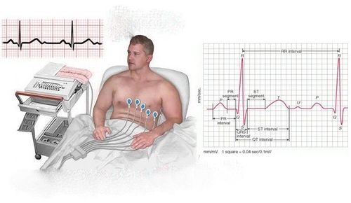 
Ghi điện tim cấp cứu tại giường
