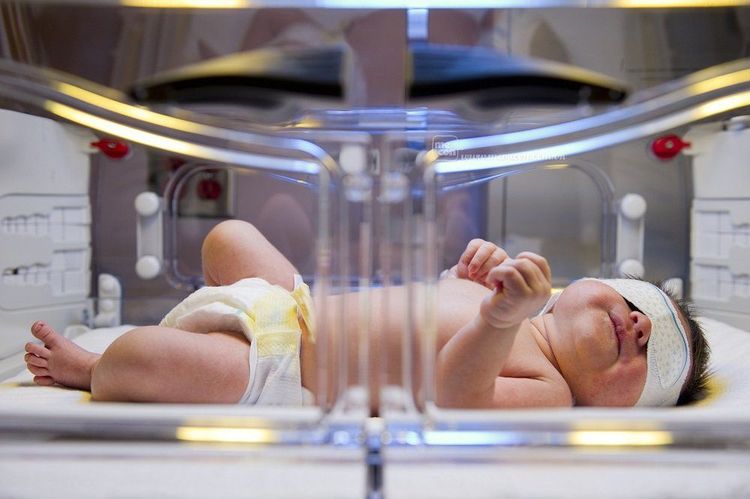 
Chiếu đèn điều trị vàng da
