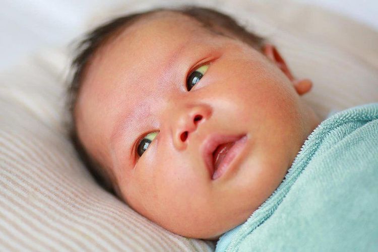 Mắt trẻ vàng nhạt nguyên nhân là gì?