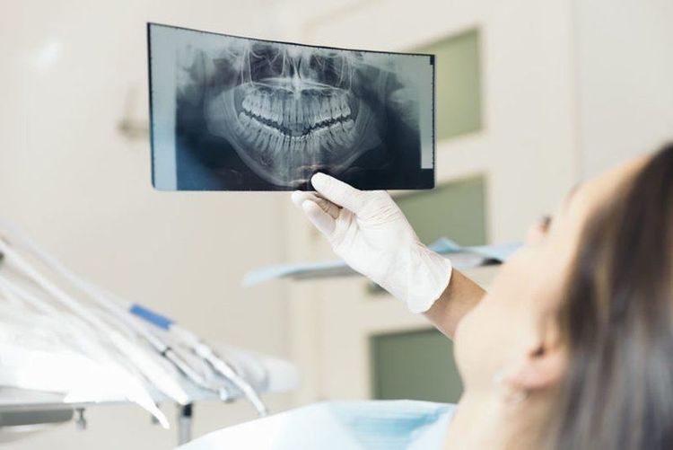 
Bạn nên chụp X-quang răng từ 2 – 3 năm một lần nếu có tiền sử về các bệnh lý răng miệng
