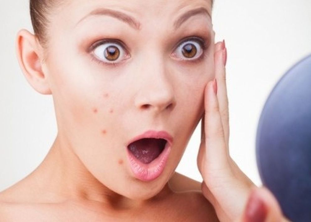 
Điều trị mụn trứng cá như thế nào?
