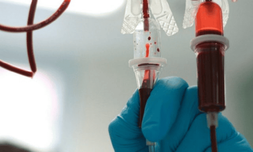 Tùy theo trường hợp mà bác sĩ sẽ chỉ định truyền máu số lượng lớn