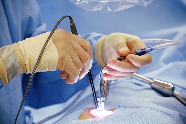 
Phương pháp phẫu thuật nội soi cắt một phần và toàn bộ thận điều trị các AVM thận đang rất được lựa chọn hiện nay
