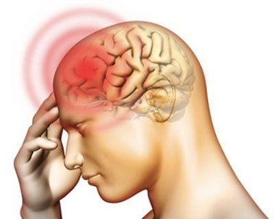 
Có 2 cơ chế chính gây ra cơn thiếu máu não cục bộ thoáng qua
