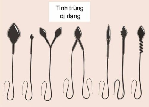 
Hình ảnh một số dạng hình thái bất thường của tinh trùng
