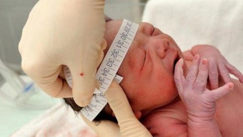 
Trẻ bị giãn não thất có kích thước hộp sọ to hơn bình thường
