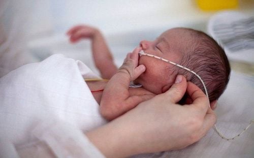 
Trẻ sơ sinh non tháng có hệ hô hấp chưa trưởng thành
